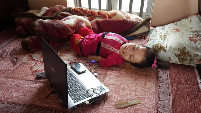 Cô gái da cam Cao Thị Út bị tàn nhưng không phế, em vẫn kiếm tiền mưu sinh như bao nhiêu người bình thường khác.