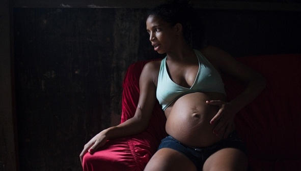 Virus Zika có thể có liên quan đến sự gia tăng tật đầu nhỏ ở trẻ em. Ảnh minh họa.