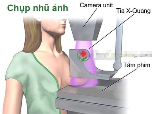Ảnh minh họa. Nguồn: Internet.