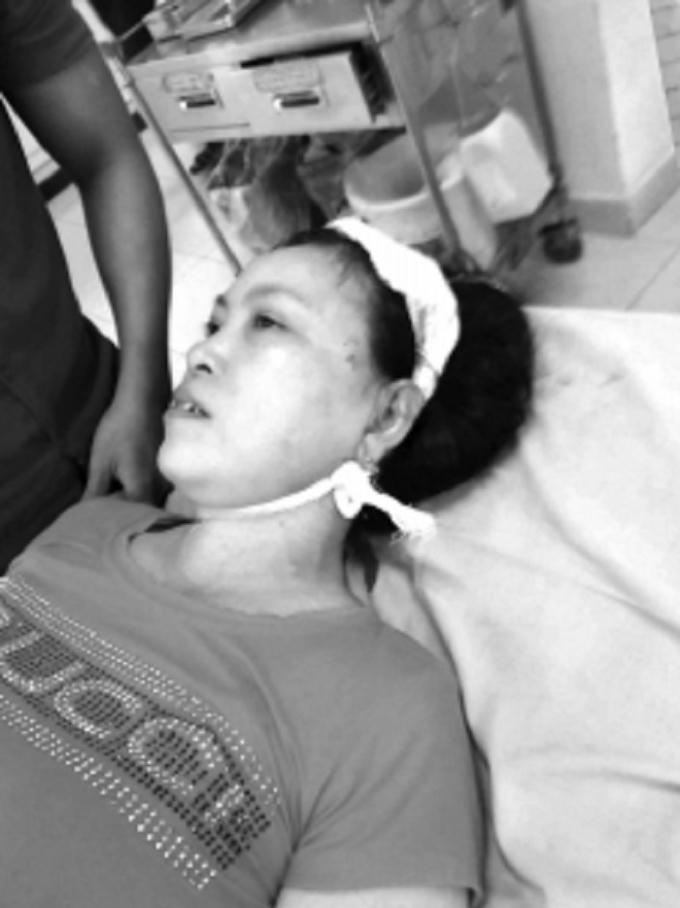 Bà Tượng tại bệnh viện và vết thương do con rể gây ra.