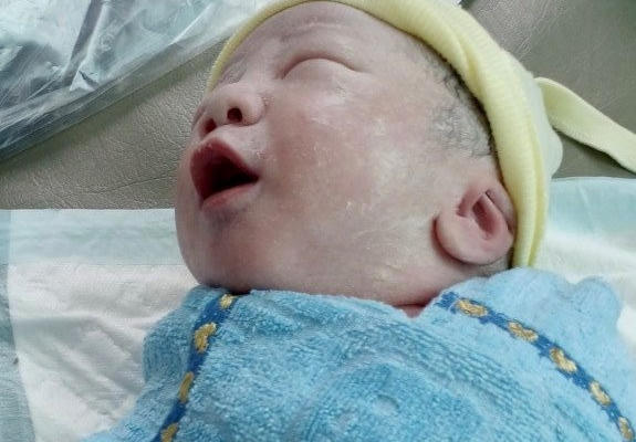 Bệnh viện Sản Nhi tỉnh Hậu Giang đã sinh mổ thành công cho một thai phụ nhiễm Covid-19