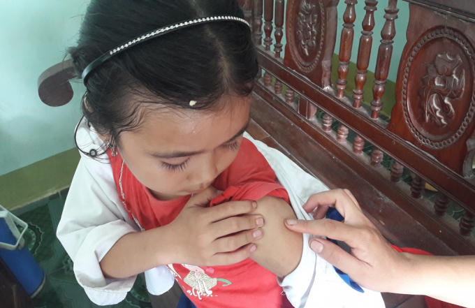 Thùy Trang chỉ vị trí mình bị người đàn ông bịt mặt tiêm thuốc. Hiện tại bé gái vẫn rất lo lắng, gia đình mong muốn cơ quan chức năng sớm làm rõ sự việc.