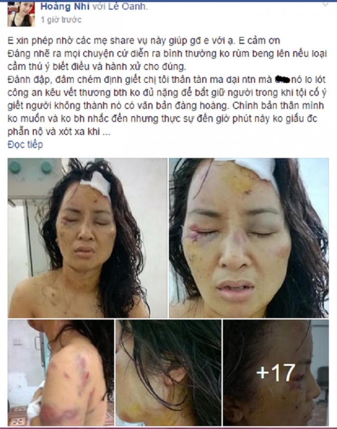 Hình ảnh người phụ nữ với những vết thương tích chi chít trên người (Nguồn: Facebook).