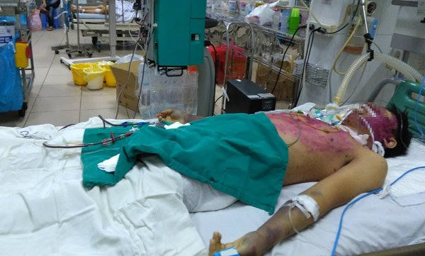 Dù được điều trị tích cực 3 ngày qua nhưng tình trạng bệnh nhân vẫn rất nguy kịch (Ảnh Vietnamnet.vn)
