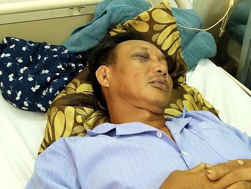 Một nạn nhân cũng bị thương tích nặng và phải nhập viện cấp cứu.
