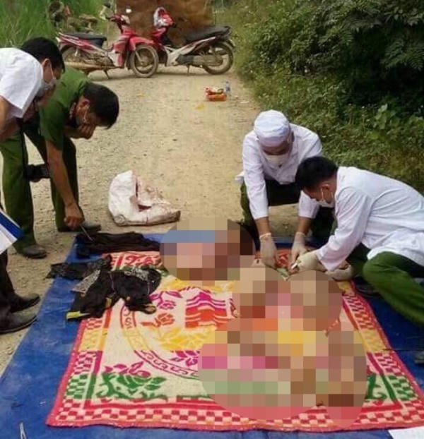 Các phần trên cơ thể của nạn nhân còn nguyên.