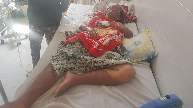 Bà Sáu cũng bỏng 60% cơ thể.