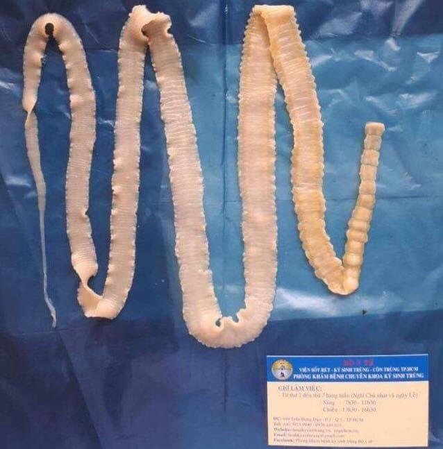 Mẫu sán dây thu hồi tại Phòng khám bệnh Chuyên khoa Ký sinh trùng,   Viện Sốt rét - Ký sinh trùng - Côn trùng TP. HCM.