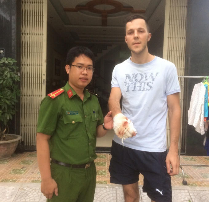 Du khách Valeria (phải) bị thương ở tay sau khi cứu 2 cháu bé. Ảnh: PCCC Đà Nẵng.