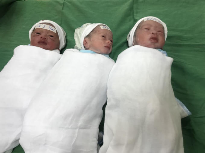 Ba cháu bé (2 gái, 1 trai) được sinh ra khỏe mạnh với sự giúp đỡ của bác sĩ bệnh viện Sản - Nhi Nghệ An.