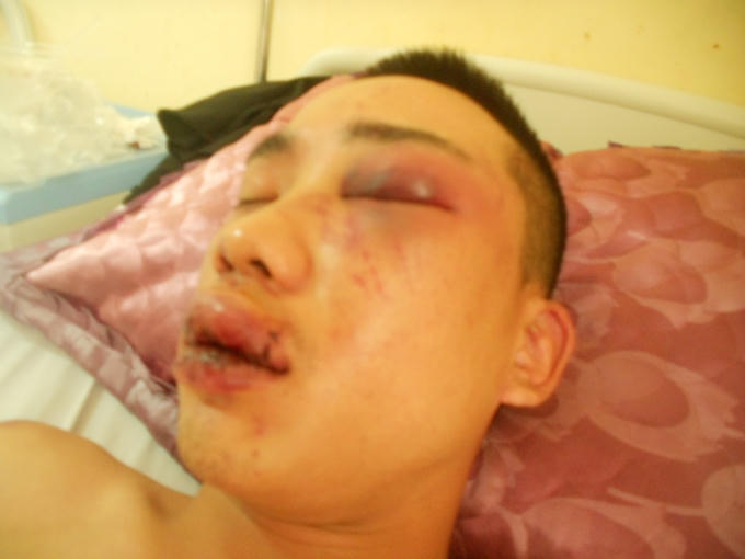 Anh Bùi Huy H.,nhập viện trong tình trạng nguy kịch.