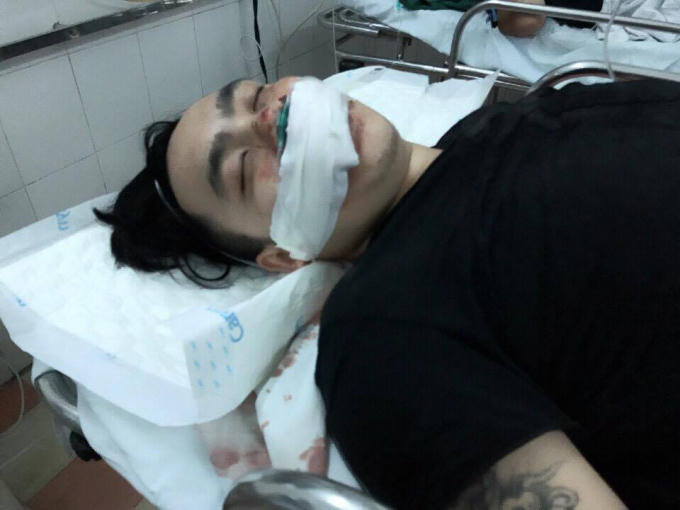 Anh Tuấn bị nhóm đối tượng chém vào lưng,đầu, vai phải nhập viện trong tình trạng đa chấn thương.