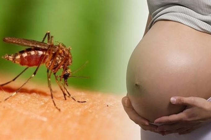 Virus Zika là một trong những nguyên nhân gây dị tật đầu nhỏ ở trẻ em. Ảnh: minh họa