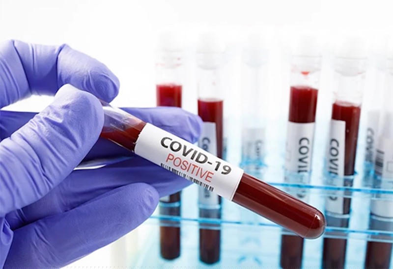 Bệnh nhân số 74 dương tính trở lại sau khi âm tính