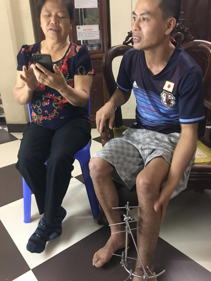 Bệnh nhân mổ tại bệnh viện bị cong chân tới nhà thuốc nhờ lương y Quý nắn lại.