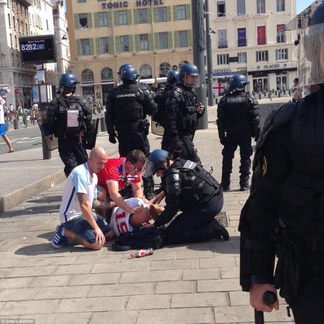 CĐV Anh bị đánh bất tỉnh.