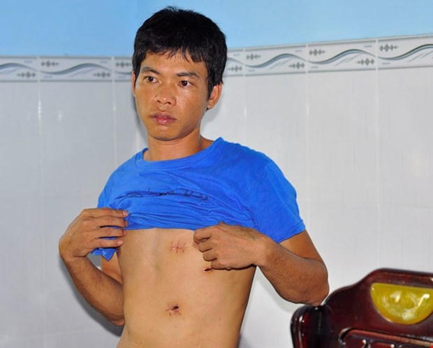 Anh Hưng với những vết thương do bị bắn.
