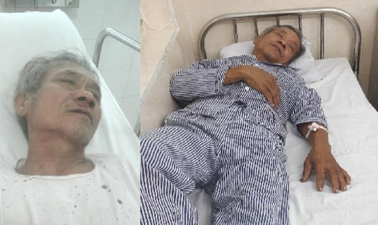 Ông Bảo điều trị tại Bệnh viện Hữu nghị Việt Tiệp và được chẩn đoán “gãy xương sườn”.