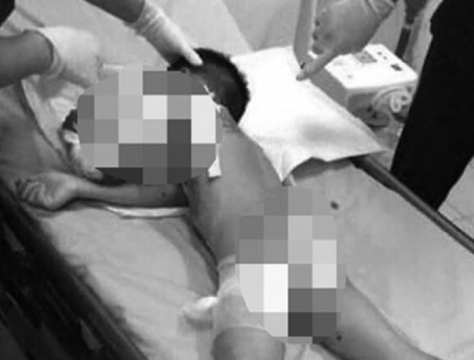 Dù được các bác sĩ tận tình cứu chữa nhưng do vết thương quá nặng, cháu N.Đ.G. đã tử vong vào chiều tối ngày 19/4.