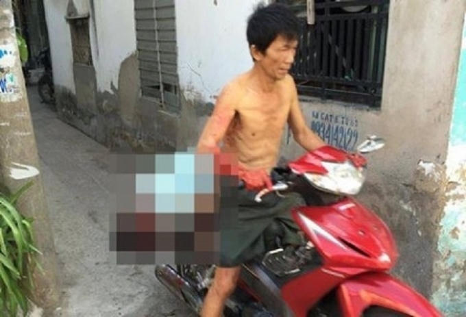 Đây là một vụ giết người máu lạnh, và chuyện đầu thú với công an khác hẳn với việc treo xác lên xe và chở đến đồn như một cách công bố "chiến tích" của mình. (Ảnh: Zing.vn)