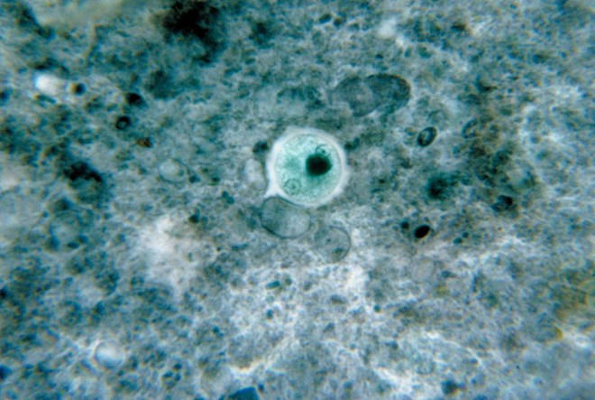 Đơn bào Entamoeba histolytica. Nguồn: wikipedia.org