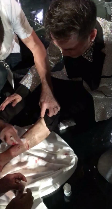 Đàm Vĩnh Hưng được mọi người sơ cứu trước khi đưa đi cấp cứu.