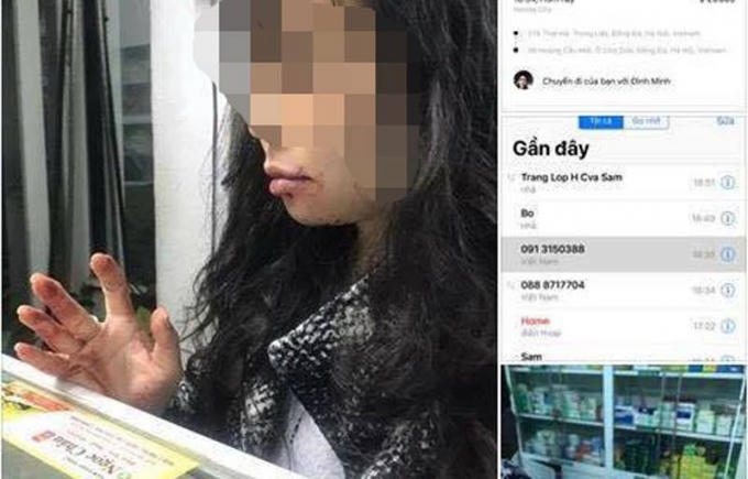 Nạn nhân trình báo, sau khi vụ việc xảy ra chị bị rất nhiều số điện thoại lạ gọi điện, nhắn tin với mục đích khủng bố tinh thần khiến chị rất mệt mỏi, áp lực.