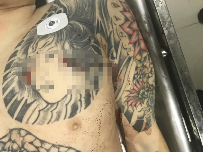 Đức "Cổ Lễ" bị đâm nhiều nhát vào tim dẫn đến tử vong.