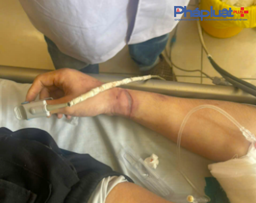 Vết thương ở cổ tay được gia định cho rằng con mình đã bị trói, và đánh đập dã man. Ảnh: Gia đình cung cấp.