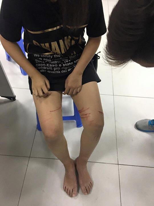 Cô gái bị "kẻ biến thái" quấy rối. Ảnh: Facebook Hạnh Vũ.