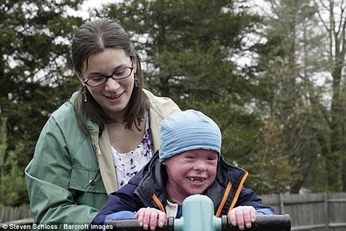 Cậu bé bị bệnh lạ cùng mẹ chơi đùa.