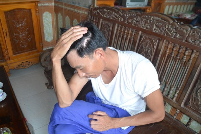 Anh Tuệ chỉ vào vết thương trước đây bị kẻ thủ ác hành hung. ( Ảnh: Phàn Giào Họ)