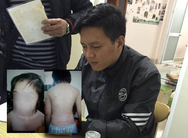 Hình ảnh Trần Hoài Nam và những vết thương của cháu K.