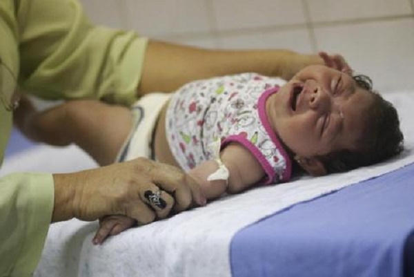 Các nhà khoa học không loại trừ khả năng từ các nguyên nhân khác khi kết hợp với nhiễm vi rút Zika gây nên những bất thường về thần kinh. Ảnh: minh họa