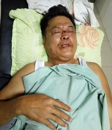 Ông Hòa được đưa đến bệnh viện điều trị sau khi bị bố con vị giám đốc đánh.