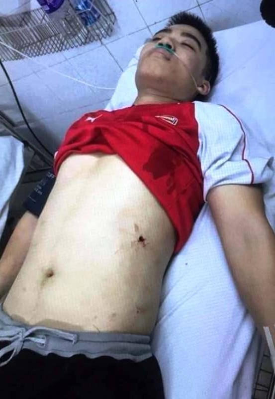 Nạn nhân của vụ hỗn chiến đang được cấp cứu.