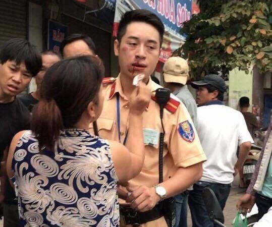 Trung úy Phạm Văn Tùng bị gãy hai răng cửa, mất nhiều máu và phải nhập viện cấp cứu.