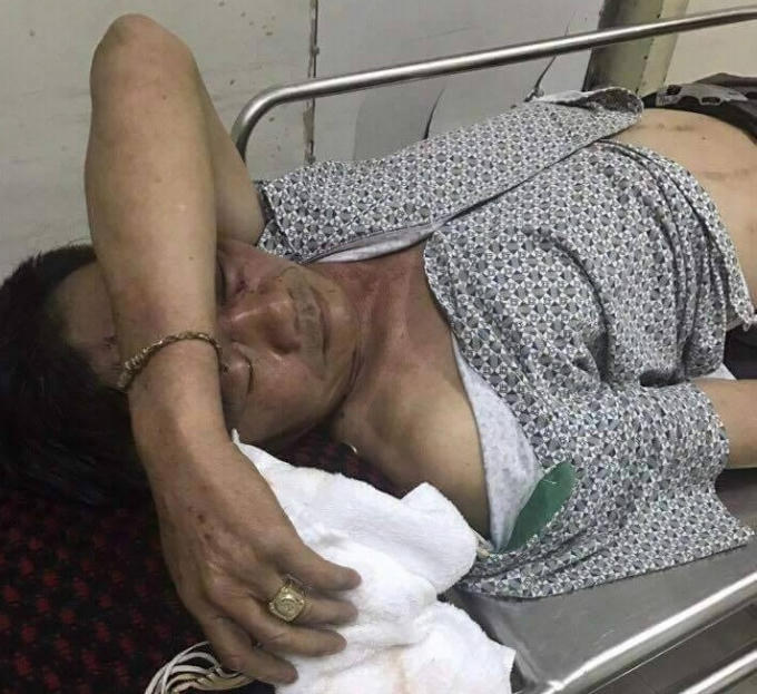 Nạn nhân bị một số đối tượng hành hung và phải đưa tới bệnh viện.