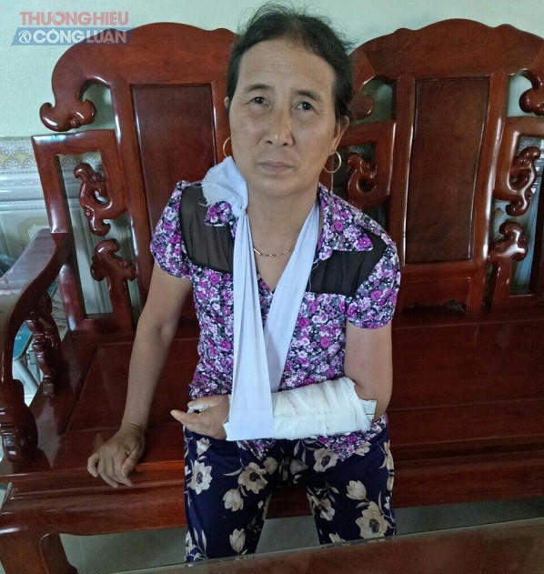 Bà Ngô Thị Nhung (vợ ông Nhâm) bị đánh gẫy tay trái.