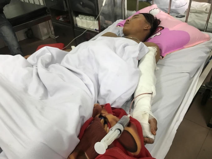 Anh Vương bị chém gần dứt lìa cánh tay trái.