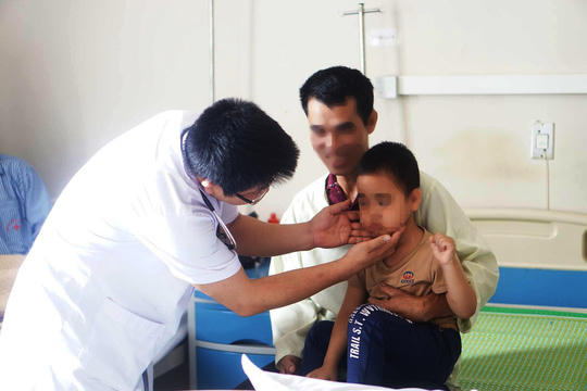 Bệnh nhi nhập viện với khuôn mặt mọc nhiều lông rậm (Ảnh: BV cung cấp)