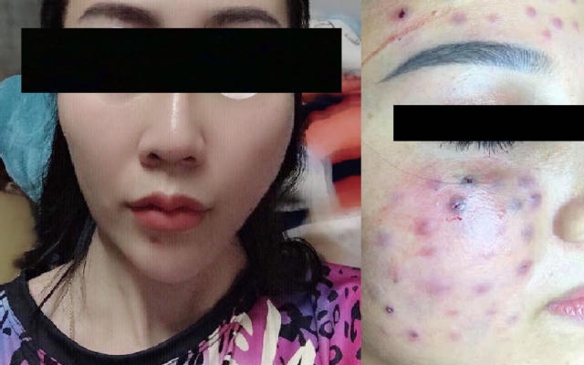 Vụ Spa