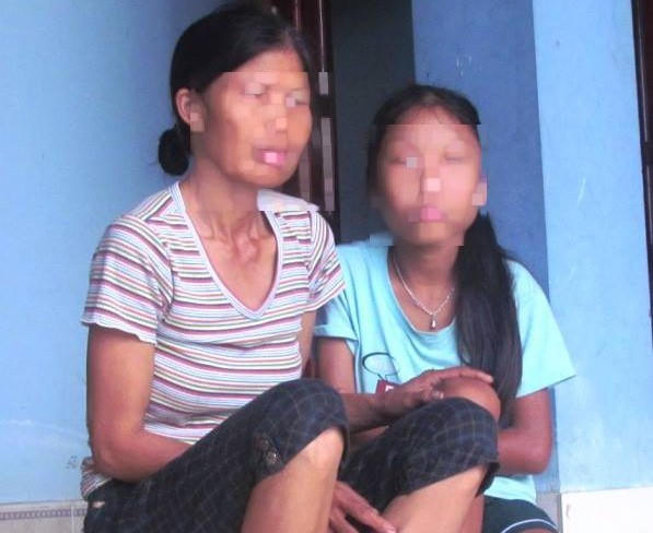 Chị H. và con gái kể lại sự việc xảy ra.
