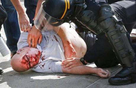 CĐV Anh bị đá vào đầu, bất tỉnh tại chỗ.