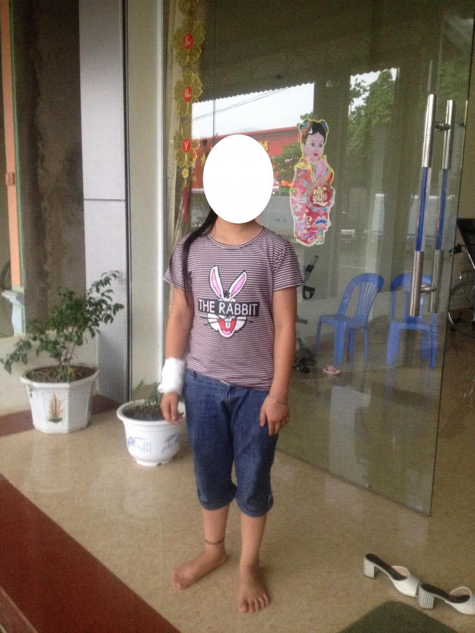 Cháu P.T.H và vết cắt ở tay để tự tử trước hành vi dâm ô của người hàng xóm là bạn của cha mình.