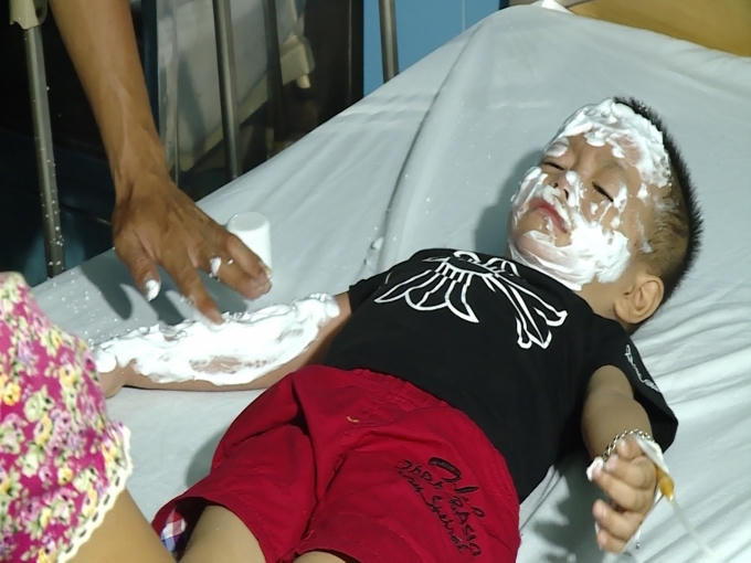 Một trong những nạn nhân đang điều trị tại Bệnh viện Cu ba - Đồng Hới.