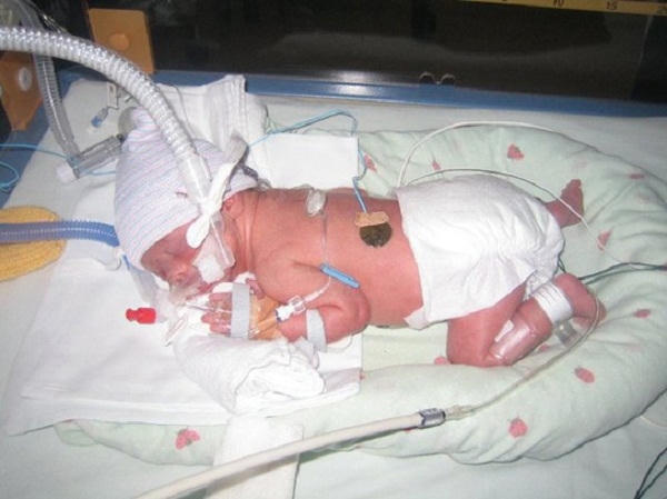 Loại virus này có thể ảnh hưởng đến não bộ của trẻ nhỏ. ẢNh: minh họa