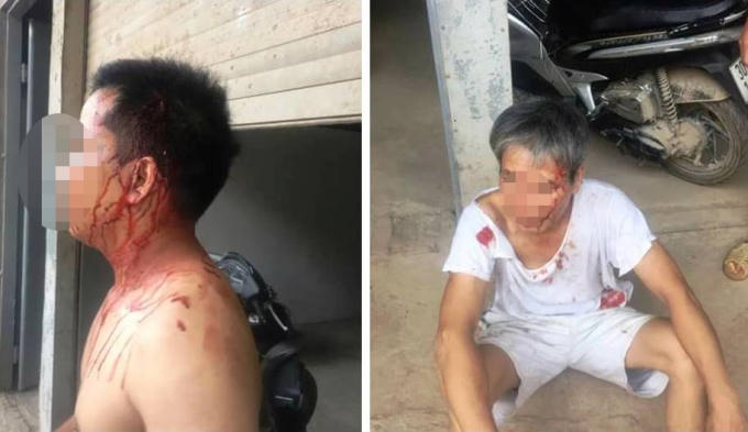 H&agrave; Nội: Hỗn chiến v&igrave;&hellip; bức tường r&agrave;o, hai người nhập viện