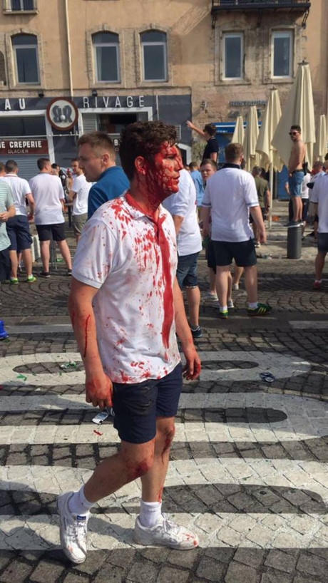 CĐV thất thểu sau khi bị tấn công.