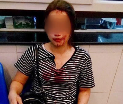 Hình ảnh cô gái trẻ bị hành hung đăng tải trên mạng xã hội. (ảnh FB H.L).